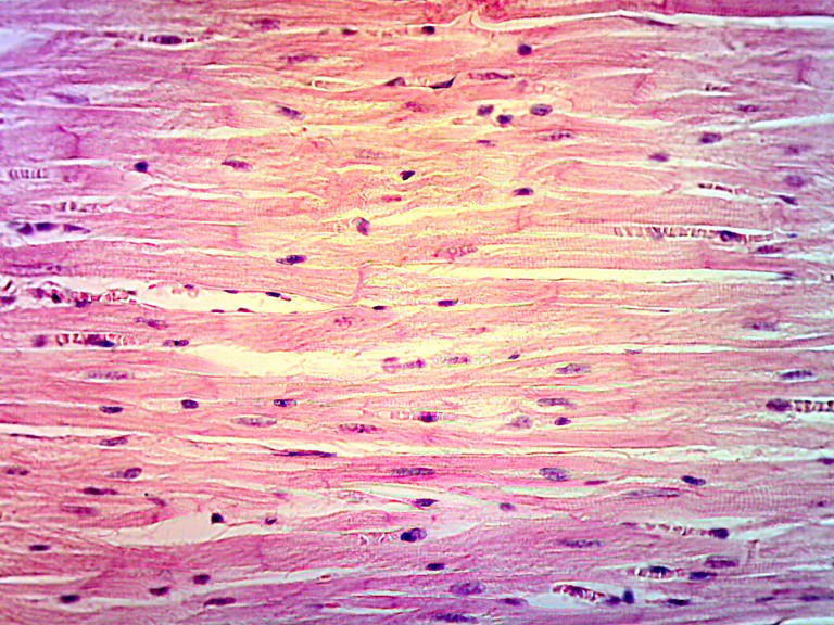 Muscle Cells - Types of Cells in the Body